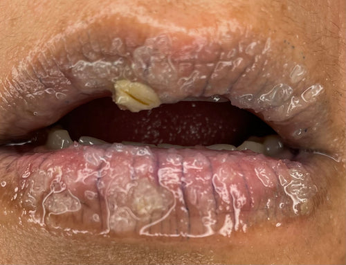 Pictured is the Oatmeal lip scrub with a sweet touch of almond 
